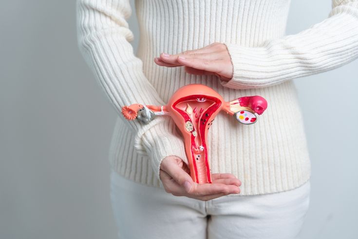 Miomas e Sangramento Uterino